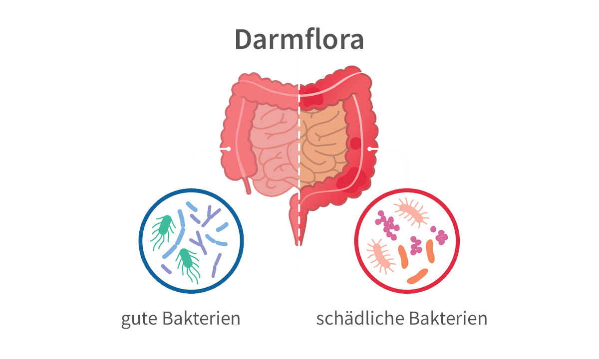 Abbildung einer Darmflora mit guten und schlechten Bakterien